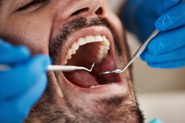 Best Pediatric Emergency Dentist in San Mateo, CA