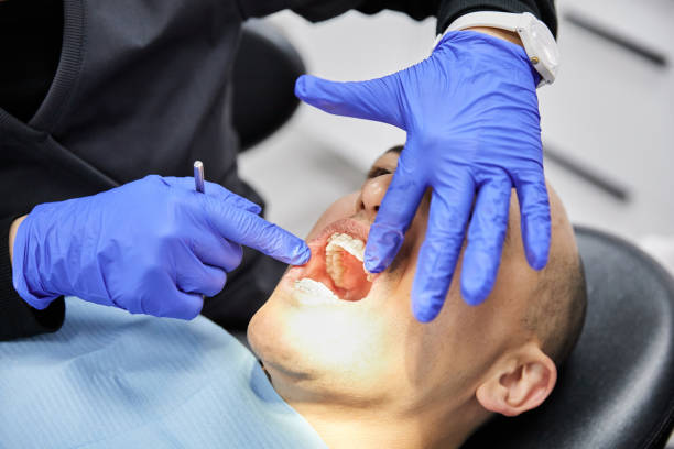 Best Emergency Dental Services for Seniors in San Mateo, CA